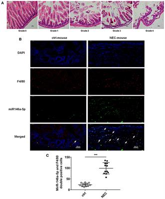 MiR-146a-5p Mimic Inhibits NLRP3 Inflammasome Downstream Inflammatory Factors and CLIC4 in Neonatal Necrotizing Enterocolitis